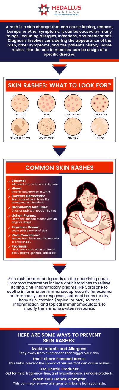 Skin Rash Treatment Doctor In Jamestown Fargo Mandan ND